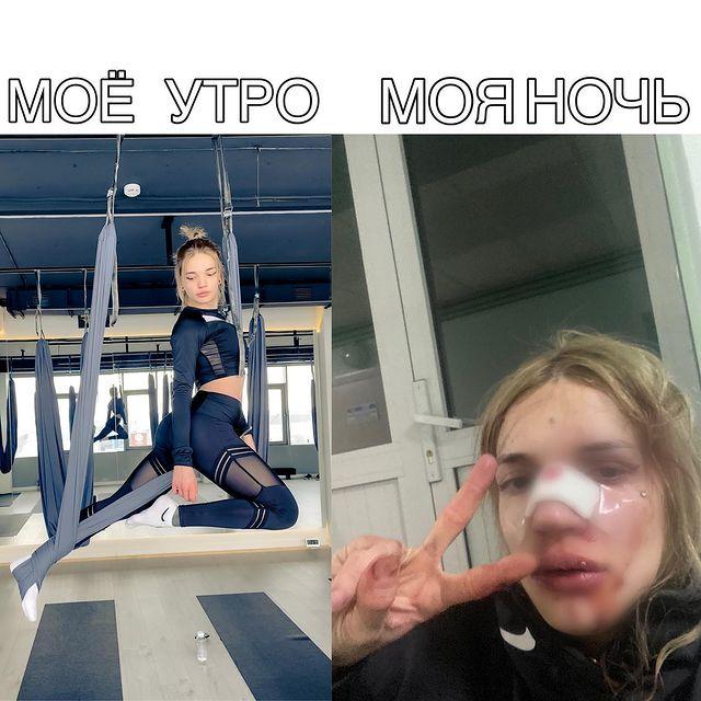 Фото «Вместо лица какое-то месиво»: пострадавшая при погроме в баре Новосибирска подала заявление в полицию 2